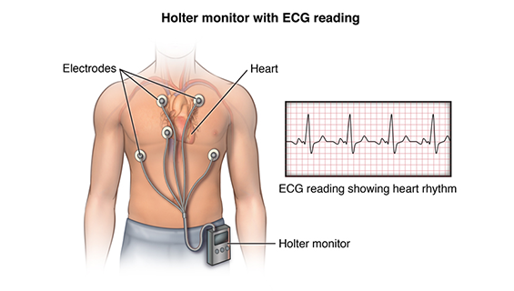 HOLTER TEST_3