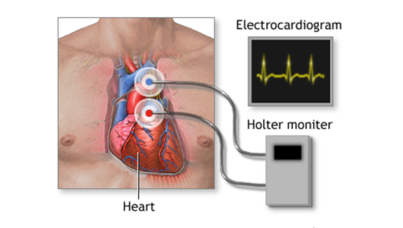 HOLTER TEST_2
